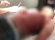 INVESTIGASI KRIMINAL: Penganiayaan Berat Satpam SMPN 2 Nabire, Polisi Kejar Pelaku Sadis